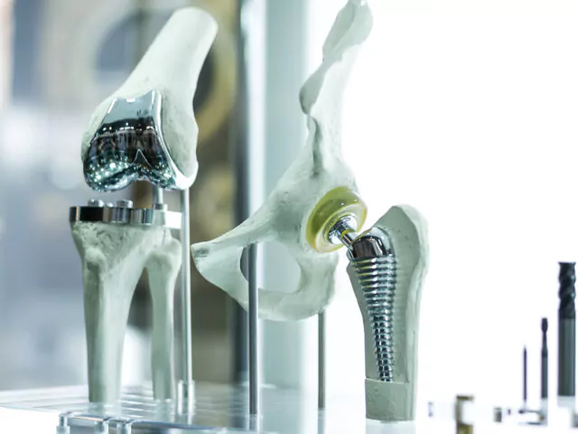 Modern knee and hip prosthesis made by cad engineer and manufactured by 3d printing